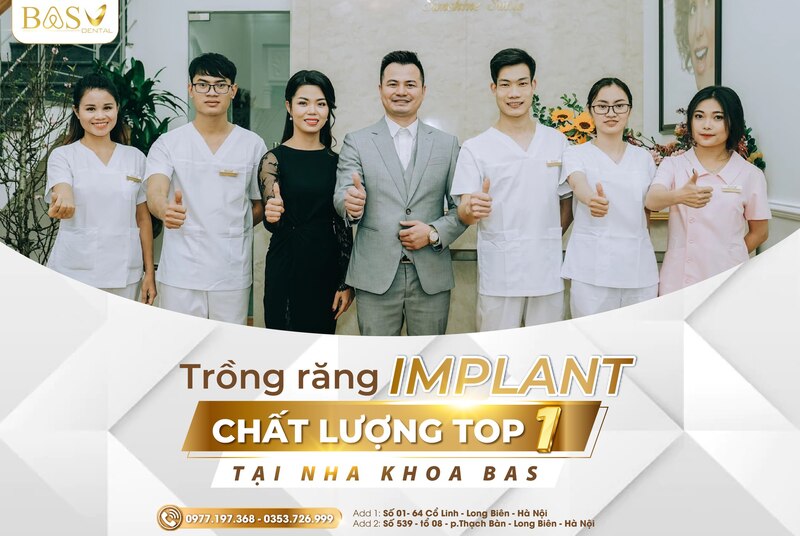 Ưu nhược điểm của trồng răng Implant - 10 điều chuyên gia tiết lộ