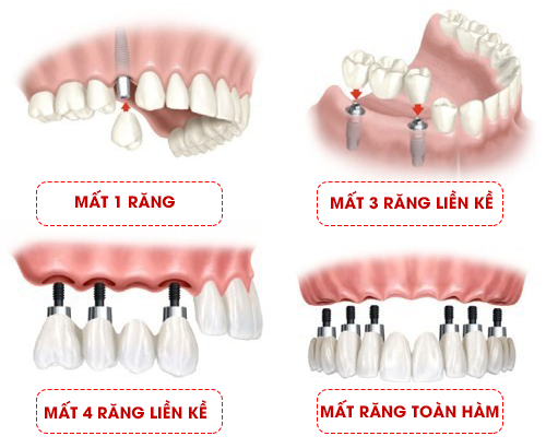 ƯU ĐIỂM