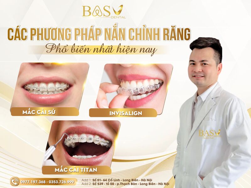 CÁC PHƯƠNG PHÁP TẠI BAS DENTAL