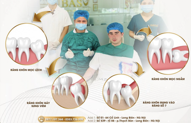 TRƯỜNG HỢP CHỈ ĐỊNH