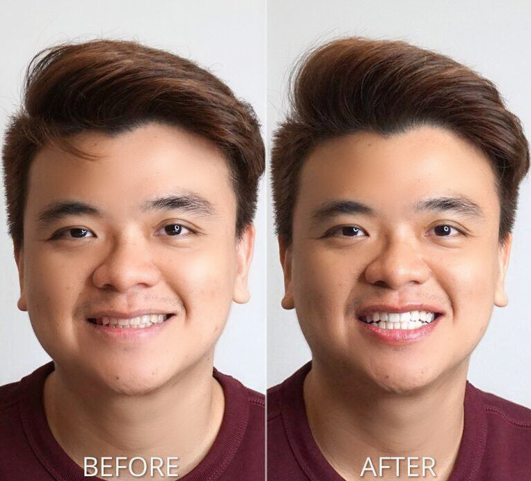 TRƯỜNG HỢP CHỈ ĐỊNH