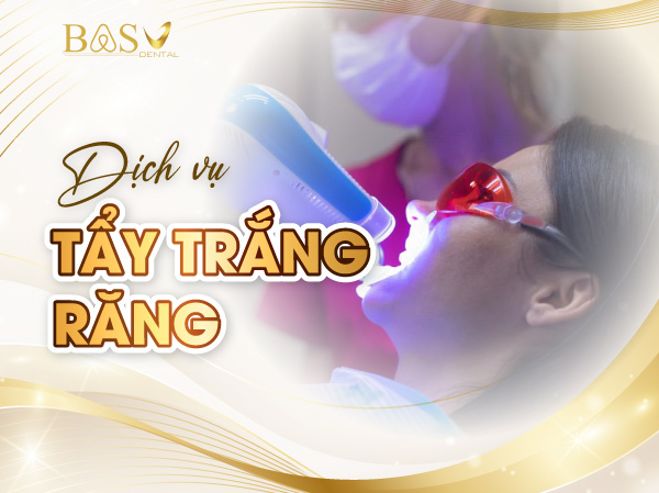 Tẩy trắng răng