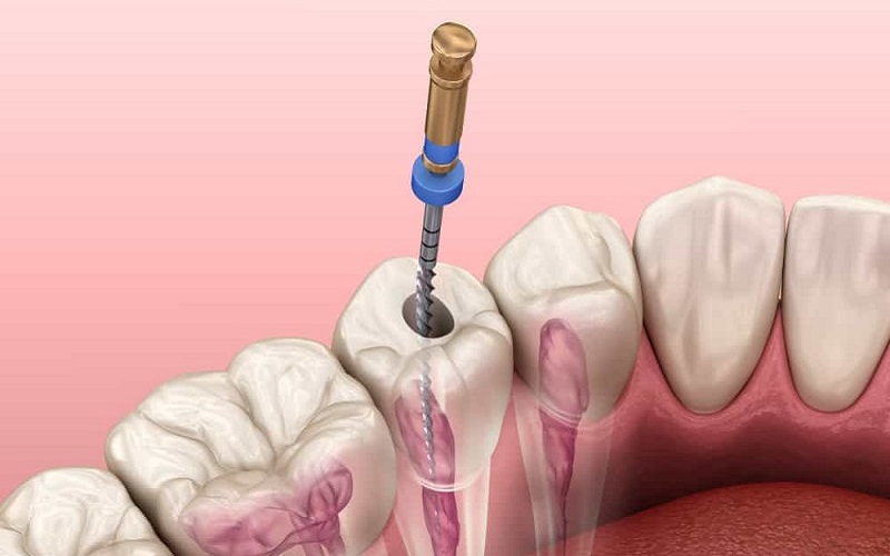 DẤU HIỆU VÀ BIẾN CHỨNG