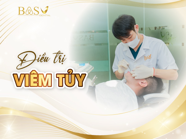 Điều trị viêm tủy